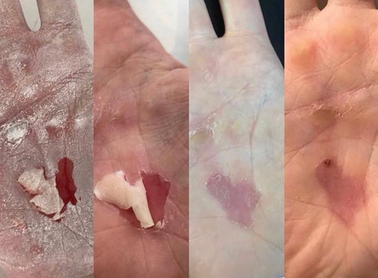 Giddy Balm Bundle Offer