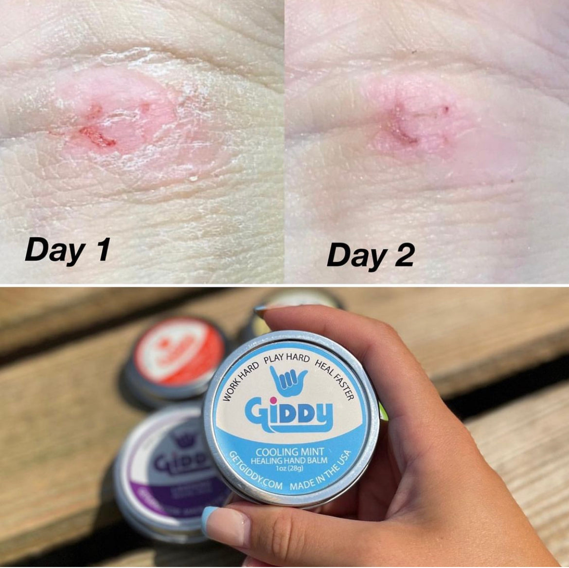 Giddy Balm Bundle Offer